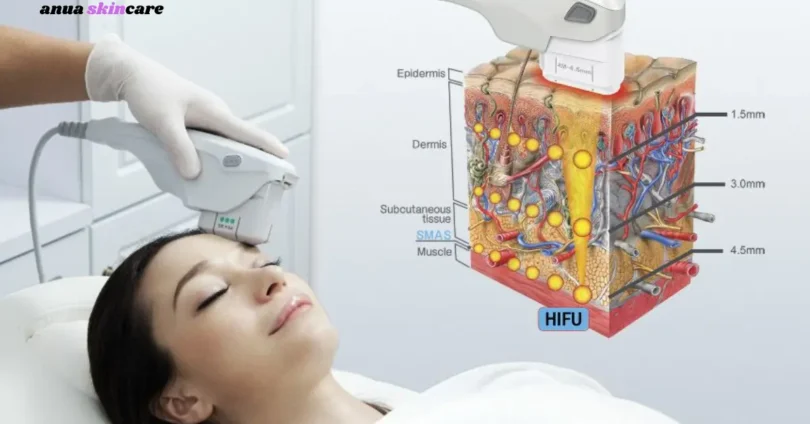 skin classic machine benefits, cost, reviews & treatment