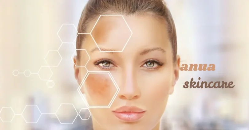 how to treat hyperpigmentation naturally at home fast