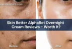 skin better alpharet overnight cream reviews – worth it