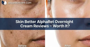 skin better alpharet overnight cream reviews – worth it