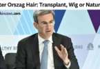 peter orszag hair transplant, wig or natural