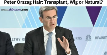 peter orszag hair transplant, wig or natural